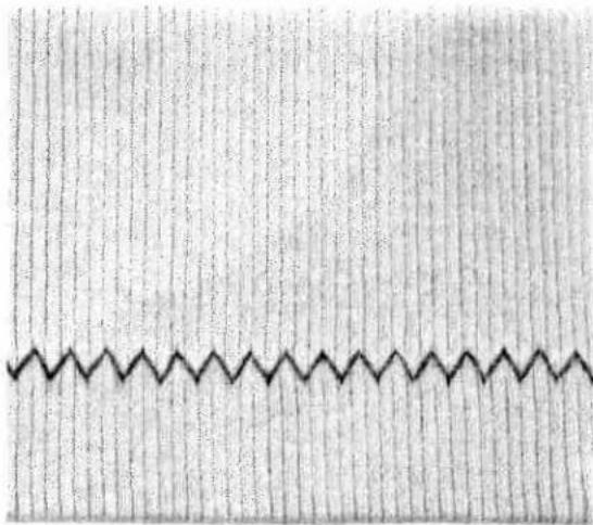 PFAFF creative 7510 - Single stem stitch - 1