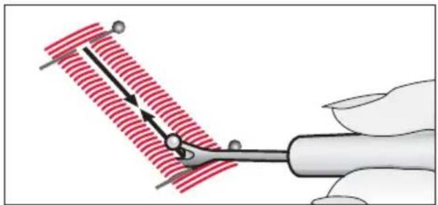 PFAFF select 2.0 - Standard buttonhole - 7