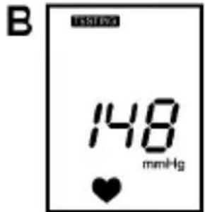 B 148 mmHg ♥