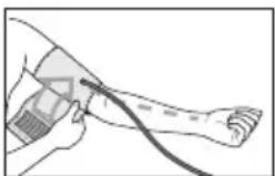 Illustration of a medical procedure showing a hand holding a tool near a leg (no text or symbols visible)