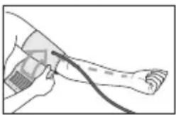 Illustration of a hand holding a medical instrument near the forearm (no text or symbols visible)