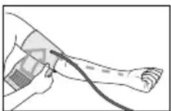 Illustration of a person's arm with a medical device attached, showing a curved line and wrist (no text or symbols)