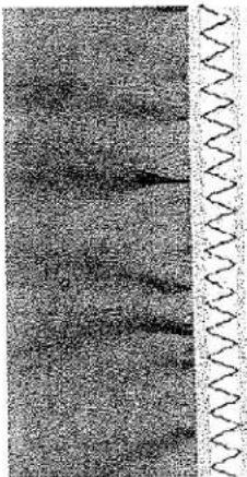 Gros plan sur une surface texturée avec des lignes verticales sombres et une ligne ondulée en dessous (aucun texte ou symbole)
