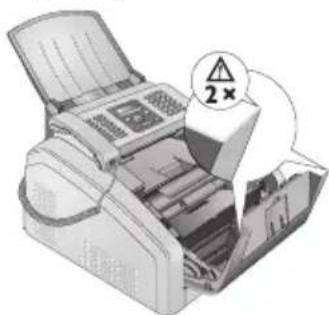 PHILIPS LPF5120 Laserfax - Bords sur le couvercle de l'appareil ! - 1