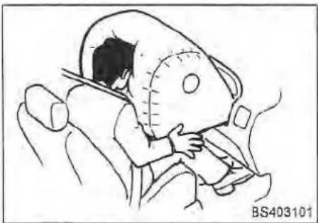 Medical illustration showing a patient undergoing a procedure on a patient's abdomen (no text or symbols present)