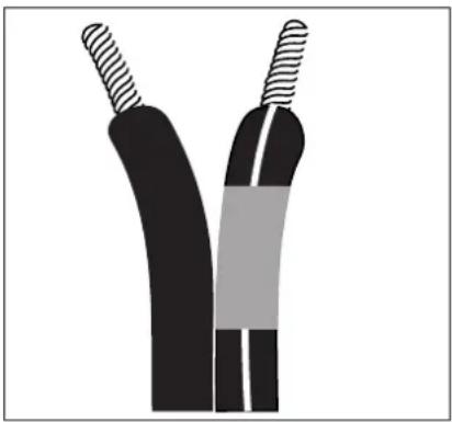 Cross-sectional illustration of two black insulated cables with coiled leads (no text or symbols)