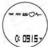 Pyle PPDM2 - Total Distance - 2