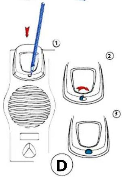 Diagram illustrating a medical procedure with labeled steps and components, including a needle insertion and three views of a device.