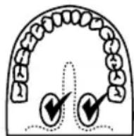 OMRON MC-301 - ORAL METHOD - 2