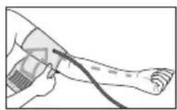 BEURER BM 85 - Applicazione del manicotto - 2