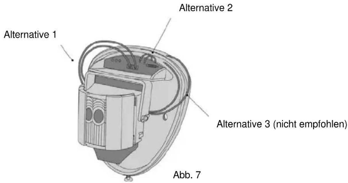 Alternative 1 Alternative 2 Alternative 3 (nicht empfohlen) Abb. 7