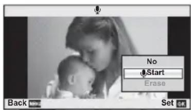 No Start Erase Back Set