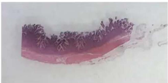 Abstract pink and purple textured pattern with no visible text or symbols