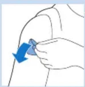 PHILIPS PulseRelief PR3840 - After use - 3