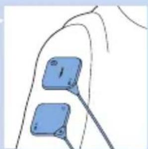 PHILIPS PulseRelief PR3840 - Ye qui est la - 12