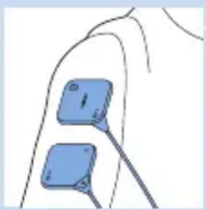 PHILIPS PulseRelief PR3840 - Connexion des électrodes et de l'appareil - 4