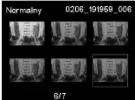 Normalny 0206_191959_006 6/7