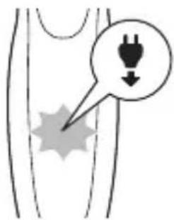 Diagram showing a plug symbol with a downward arrow pointing to a star-shaped object, likely indicating a warning or hazard.