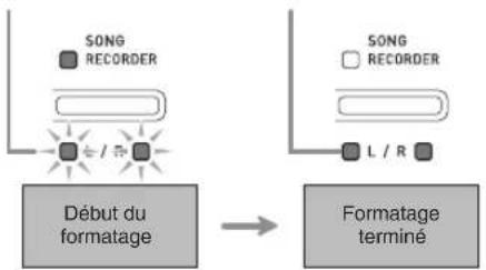 CASIO PX-860BN - Appuyez sur le bouton START/STOP ▶/■. - 1