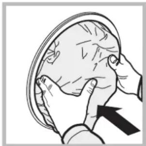 Illustration of hands performing a medical or surgical procedure on a patient's head (no text or symbols present)