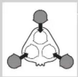 graph TD A["Top Node"] --> B["Bottom Left Node"] B --> C["Bottom Right Node"] C --> D["Bottom Left Node"]