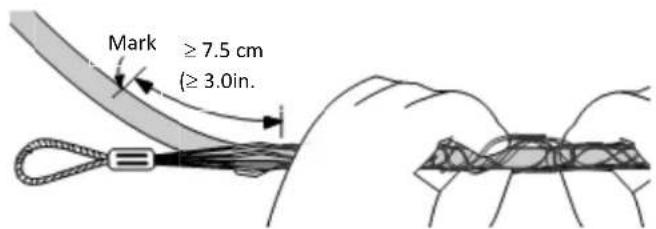 Mark ≥ 7.5 cm (≥ 3.0in.