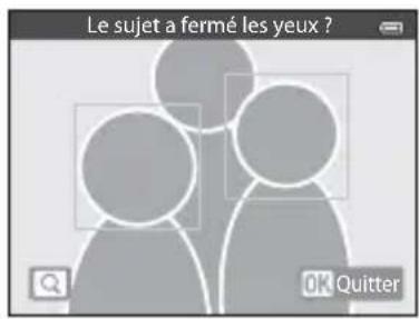 Le sujet a fermé les yeux ? OK Quitter