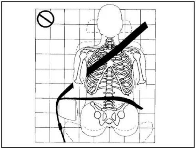 Medical diagram showing human skeleton with a diagonal line and a no-smoking symbol, overlaid on a grid background.