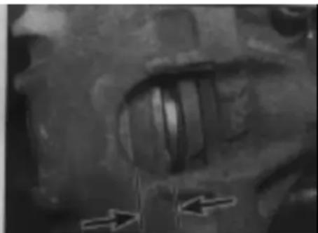 VOLKSWAGEN Polo (1990) - Front brake pad check - 2