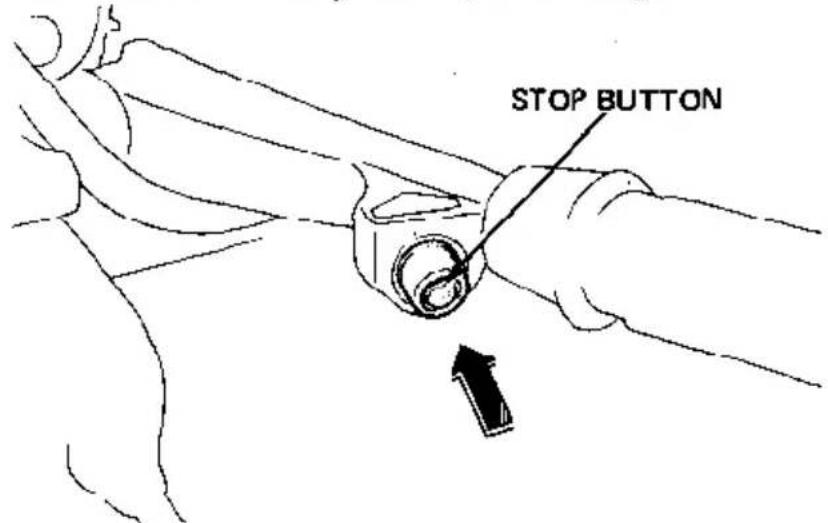 STOP BUTTON