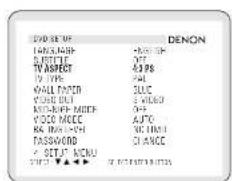 DVD SET OF DENON TAXXXXX +0.0% S:TTLE +7% TV ASPECT +3 PS TV TYPE +2L WALL FANER 3UC VOCO OUT 3 VIDEO MOS-RIFP-MOCK 0+ VIDEO MCCC AFCO R4 INCHY 3C1/M1 TASSAWOND CHANCE △ SITU" MENU √ ▼▲▼ ▼ 20% 50% 100%