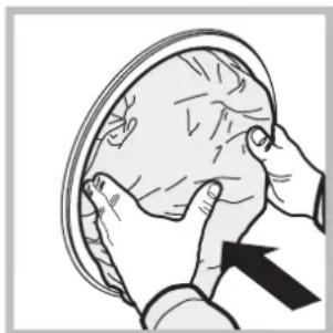 Illustration of hands performing a medical procedure on a patient's head (no text or symbols present).