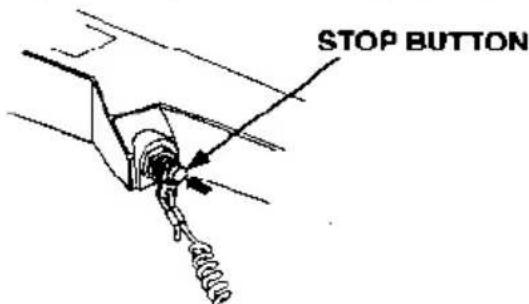 STOP BUTTON