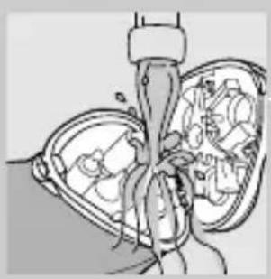 Anatomical illustration of human lungs and heart chambers (no text or labels)