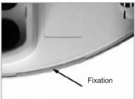 Fixation