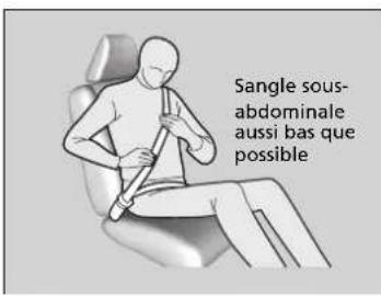 Sangle sous-abdominale aussi bas que possible