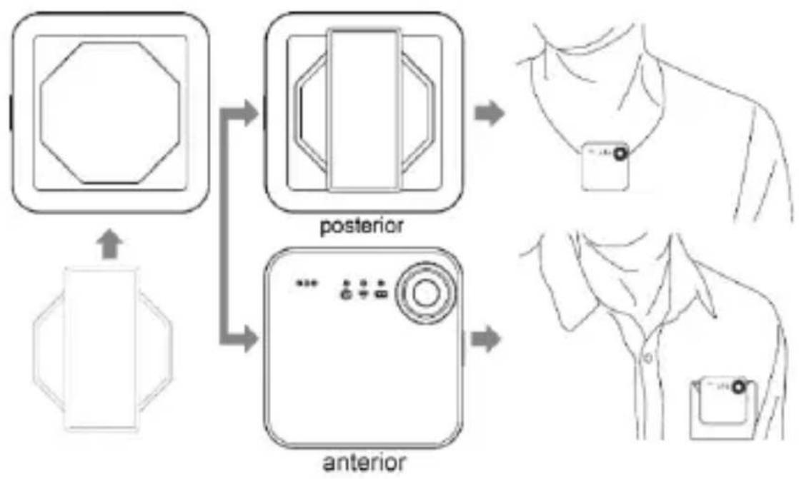 graph TD A["Geometric Shape"] --> B["Camera"] C["Posterior"] --> D["Anterior"] B --> E["Clothing Screen"] D --> F["Clothing Jacket"]