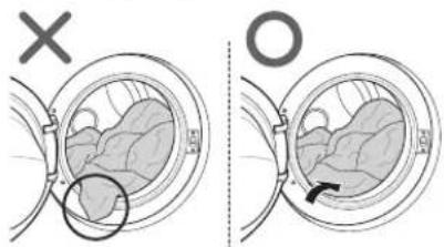 Medical diagram showing a cross-section of a patient's abdomen with an X and O markers, likely illustrating a surgical or anatomical procedure.