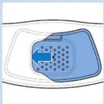 PHILIPS PR3731 - Posicionamento da faixa da região lombar - 1