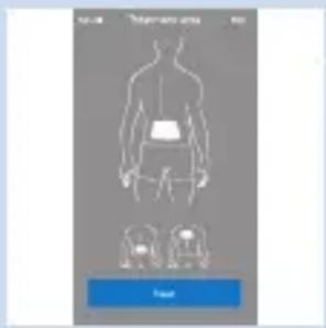 Medical diagram showing human body with internal organs and two labeled anatomical structures below, likely for surgical or diagnostic purposes.