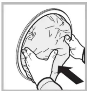 Illustration of hands performing a medical or surgical procedure on a circular object, with an arrow indicating direction (no text or symbols present)