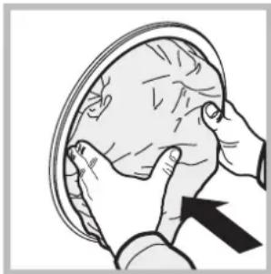 Illustration of hands performing a medical or surgical procedure on a patient's head (no text or symbols present)