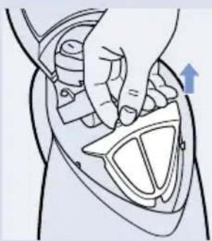 Anatomical illustration of pelvic anatomy with a blue arrow indicating a specific area (no text or labels present)