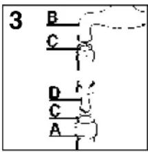 3 : B, C, D, C, A