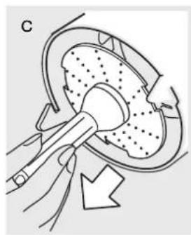 Diagram of a medical procedure showing a tool interacting with a circular device (no text or symbols present)