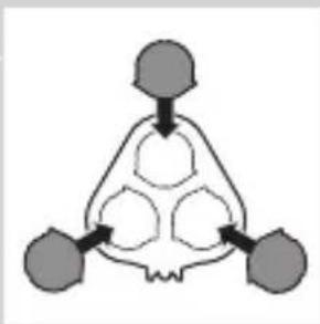 graph TD A["Top Node"] --> B{Decision} B --> C["Left Node"] B --> D["Right Node"] B --> E["Bottom Node"]