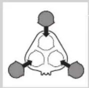 graph TD A["Top Node"] --> B{Decision} B --> C["Left Node"] B --> D["Right Node"] B --> E["Bottom Node"]