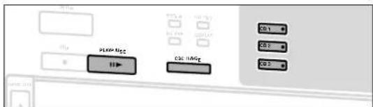 PLXP Msc CGM HAGc