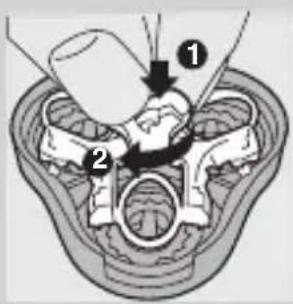Medical diagram showing anatomical structures with numbered labels and directional arrows indicating process or measurement.