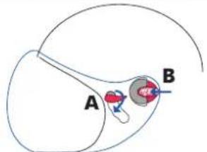 A B